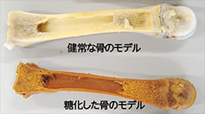 またAGEsが骨にたまると、骨が本当に焦げたように茶色く変色します。変色した骨は強度がなくなり、骨粗しょう症のリスクを高める危険性があります。